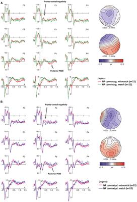 Corrigendum: Eliciting ERP Components for Morphosyntactic Agreement Mismatches in Perfectly Grammatical Sentences